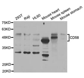 Western blot - CD58 Antibody from Signalway Antibody (32972) - Antibodies.com