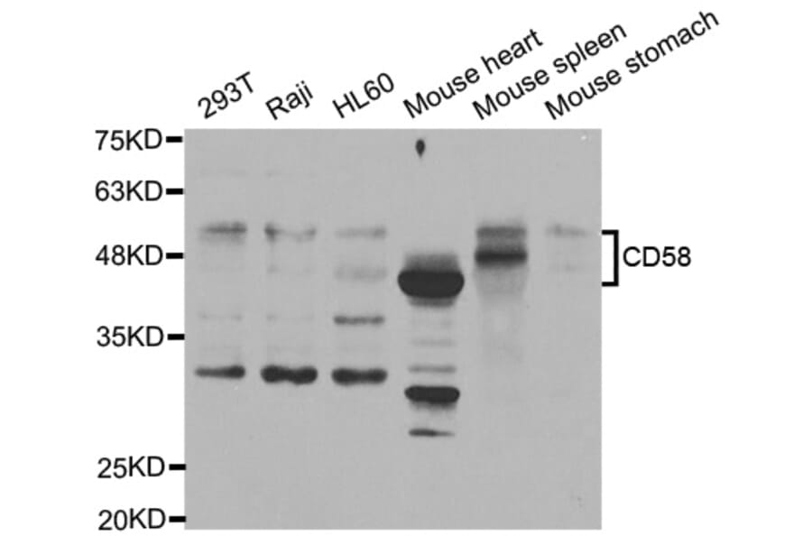 Western blot - CD58 Antibody from Signalway Antibody (32972) - Antibodies.com