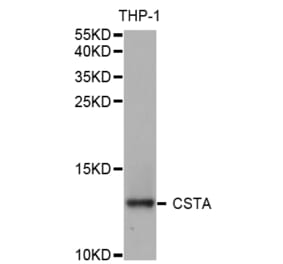 Western blot - CSTA Antibody from Signalway Antibody (32973) - Antibodies.com