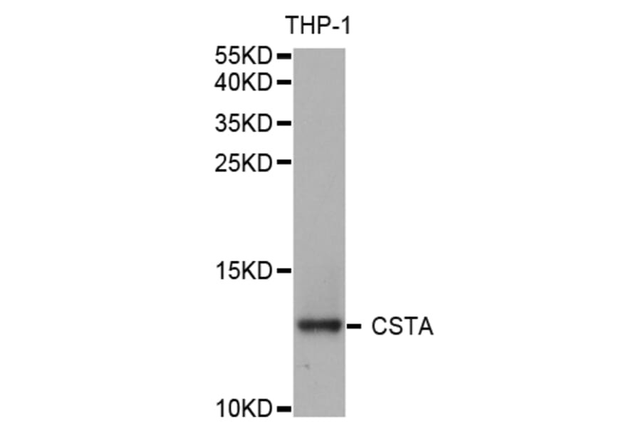 Western blot - CSTA Antibody from Signalway Antibody (32973) - Antibodies.com