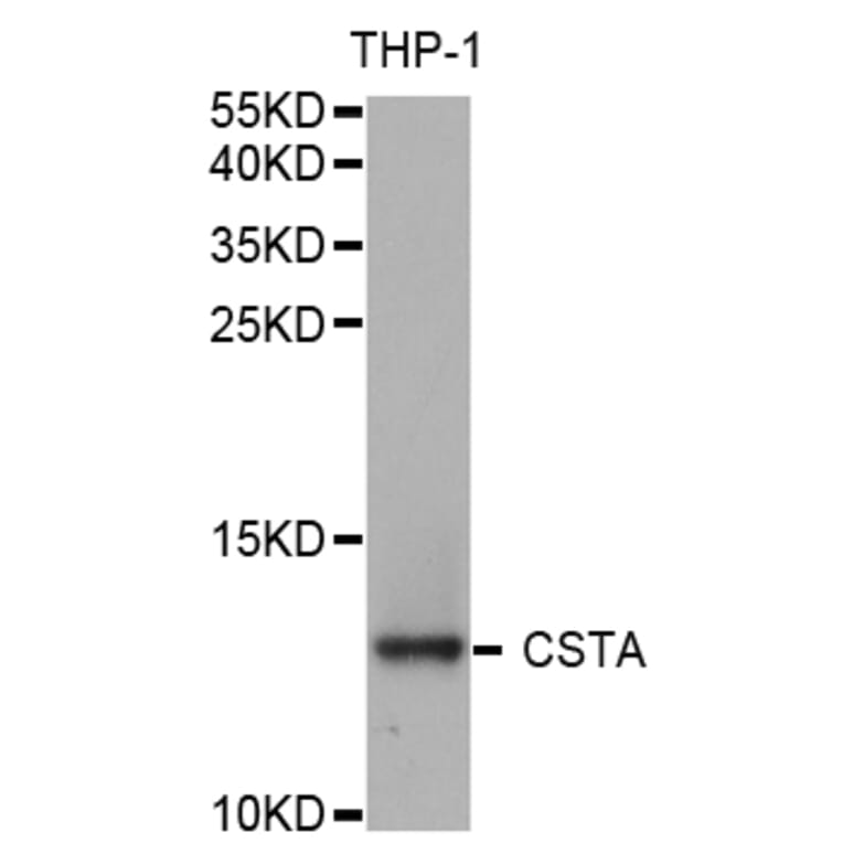 Western blot - CSTA Antibody from Signalway Antibody (32973) - Antibodies.com