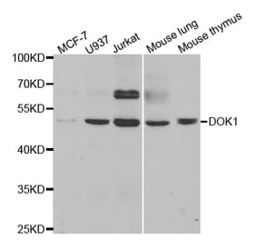 Western blot - DOK1 Antibody from Signalway Antibody (32974) - Antibodies.com