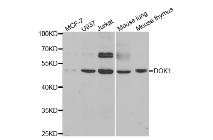 Western blot - DOK1 Antibody from Signalway Antibody (32974) - Antibodies.com