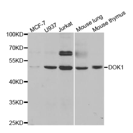 Western blot - DOK1 Antibody from Signalway Antibody (32974) - Antibodies.com