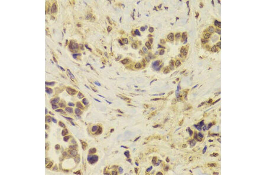 Immunohistochemistry - DOK1 Antibody from Signalway Antibody (32974) - Antibodies.com