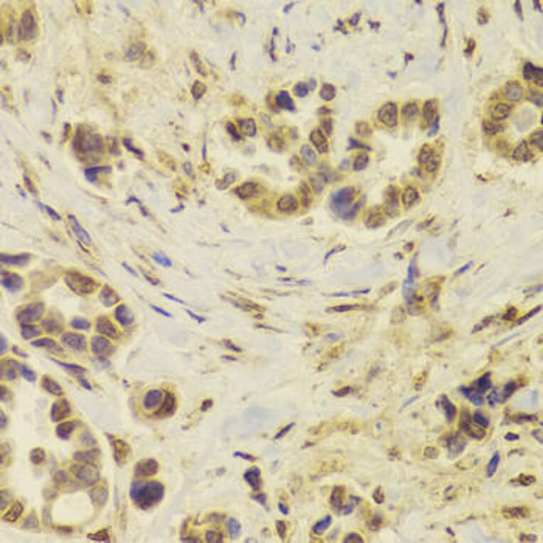 Immunohistochemistry - DOK1 Antibody from Signalway Antibody (32974) - Antibodies.com