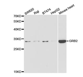 Western blot - GRB2 Antibody from Signalway Antibody (32976) - Antibodies.com