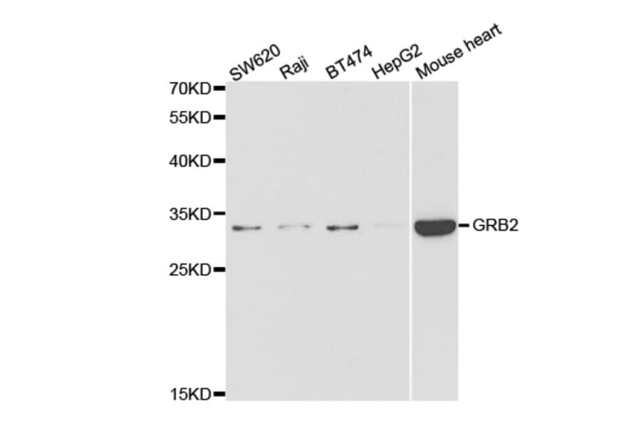 Western blot - GRB2 Antibody from Signalway Antibody (32976) - Antibodies.com