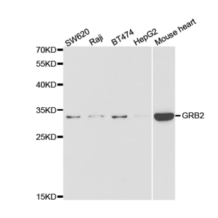 Western blot - GRB2 Antibody from Signalway Antibody (32976) - Antibodies.com