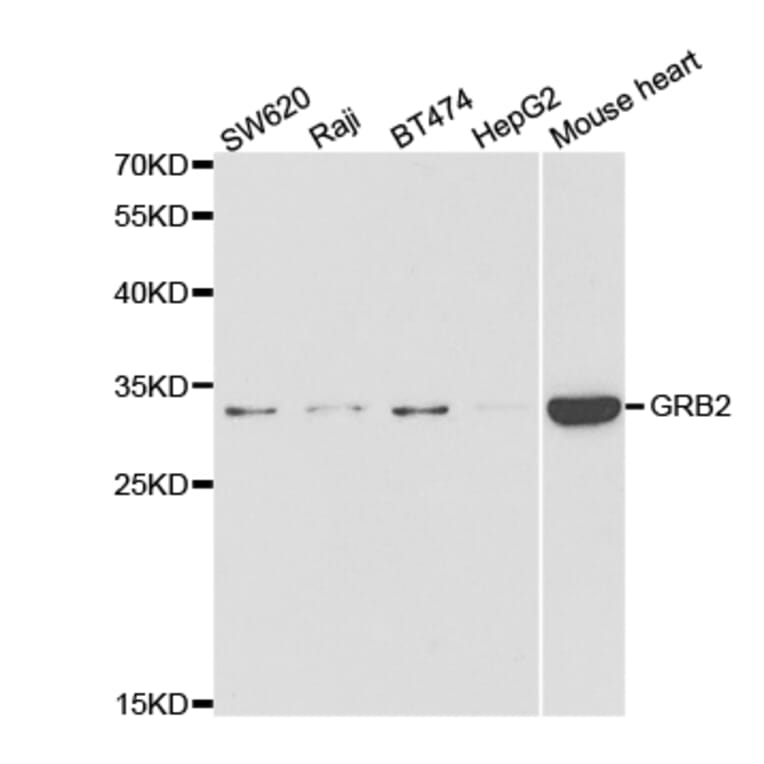 Western blot - GRB2 Antibody from Signalway Antibody (32976) - Antibodies.com