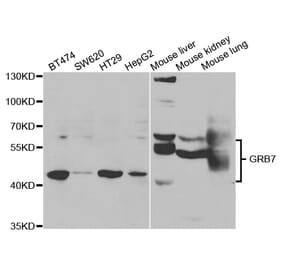 Western blot - GRB7 Antibody from Signalway Antibody (32977) - Antibodies.com