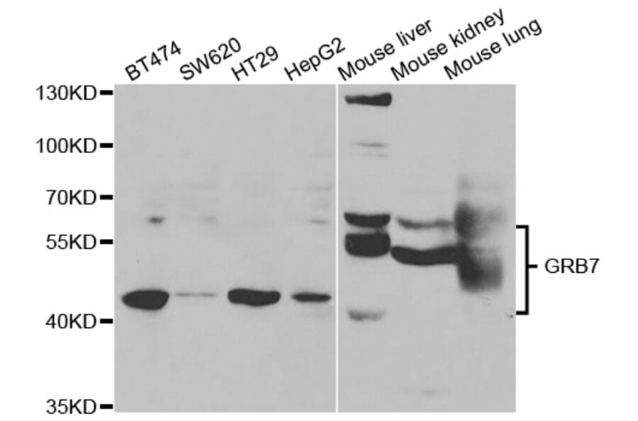Western blot - GRB7 Antibody from Signalway Antibody (32977) - Antibodies.com