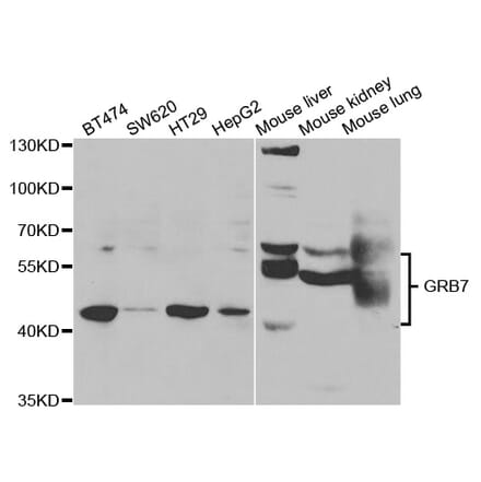 Western blot - GRB7 Antibody from Signalway Antibody (32977) - Antibodies.com