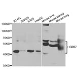 Western blot - GRB7 Antibody from Signalway Antibody (32977) - Antibodies.com