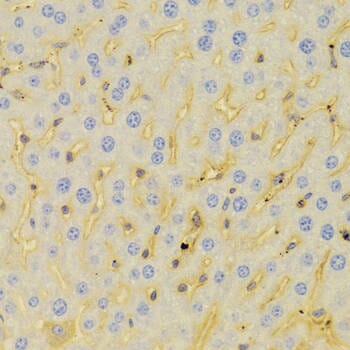 Immunohistochemistry of paraffin-embedded Mouse liver using PCM1 antibody at dilution of 1: 100 (x400 lens).