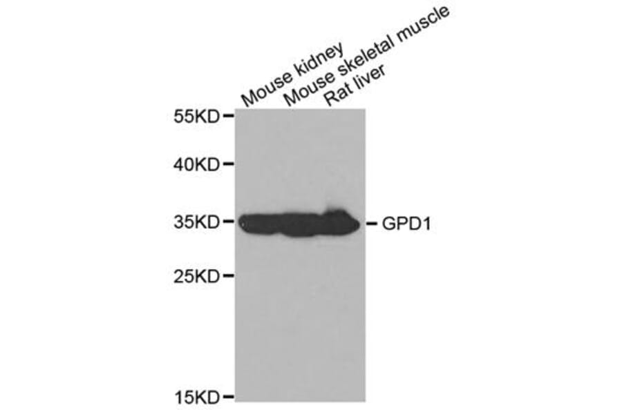 Western blot - GPD1 Antibody from Signalway Antibody (32990) - Antibodies.com