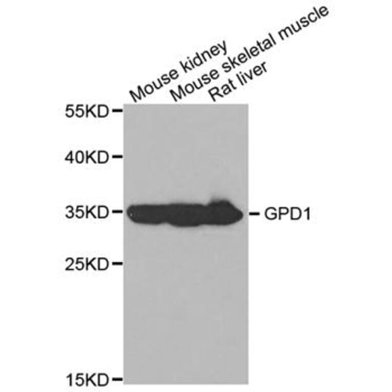 Western blot - GPD1 Antibody from Signalway Antibody (32990) - Antibodies.com