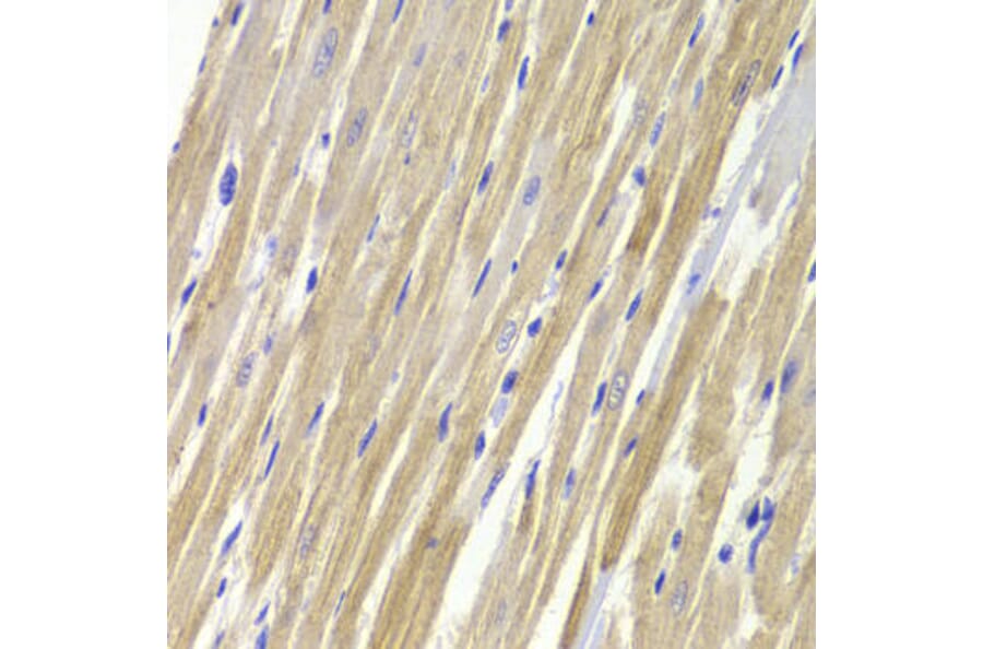 Immunohistochemistry - GPD1 Antibody from Signalway Antibody (32990) - Antibodies.com