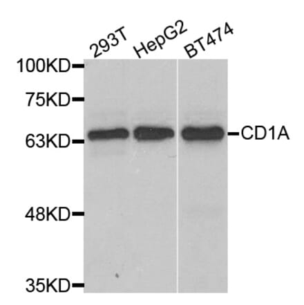 Western blot - CD1A Antibody from Signalway Antibody (32993) - Antibodies.com