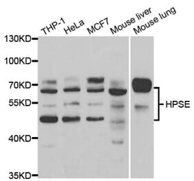 Western blot - HPSE Antibody from Signalway Antibody (32996) - Antibodies.com