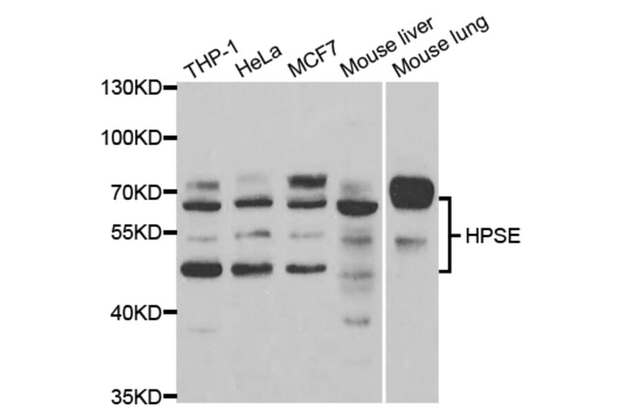 Western blot - HPSE Antibody from Signalway Antibody (32996) - Antibodies.com