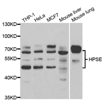 Western blot - HPSE Antibody from Signalway Antibody (32996) - Antibodies.com