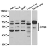 Western blot - HPSE Antibody from Signalway Antibody (32996) - Antibodies.com