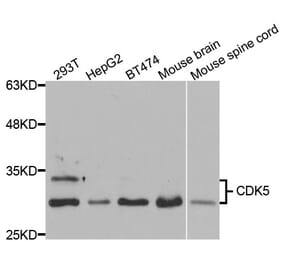 Western blot - CDK5 Antibody from Signalway Antibody (32998) - Antibodies.com