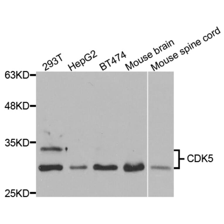 Western blot - CDK5 Antibody from Signalway Antibody (32998) - Antibodies.com