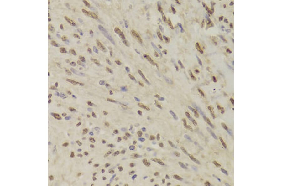 Immunohistochemistry - QDPR Antibody from Signalway Antibody (33000) - Antibodies.com