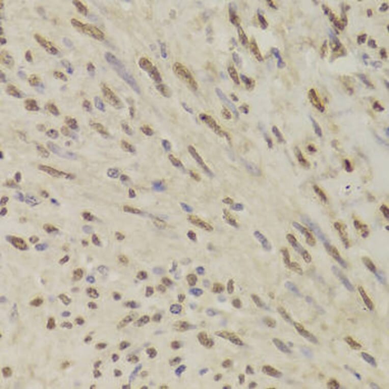 Immunohistochemistry - QDPR Antibody from Signalway Antibody (33000) - Antibodies.com