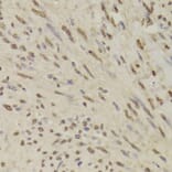 Immunohistochemistry - QDPR Antibody from Signalway Antibody (33000) - Antibodies.com