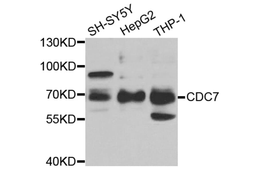 Western blot - CDC7 Antibody from Signalway Antibody (33004) - Antibodies.com