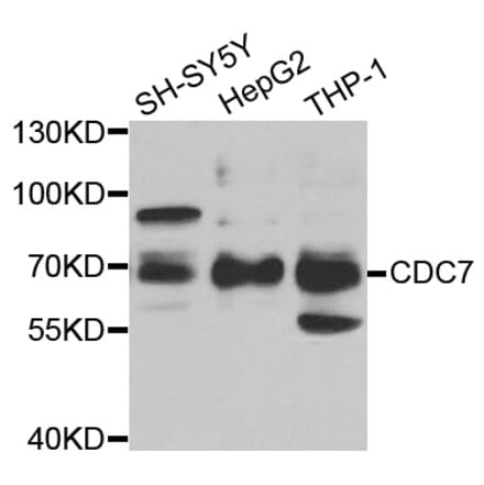 Western blot - CDC7 Antibody from Signalway Antibody (33004) - Antibodies.com