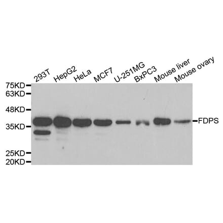 Western blot - FDPS Antibody from Signalway Antibody (33010) - Antibodies.com