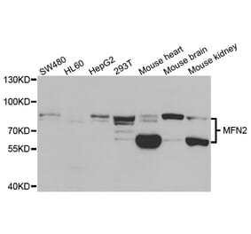 Western blot - MFN2 Antibody from Signalway Antibody (33015) - Antibodies.com