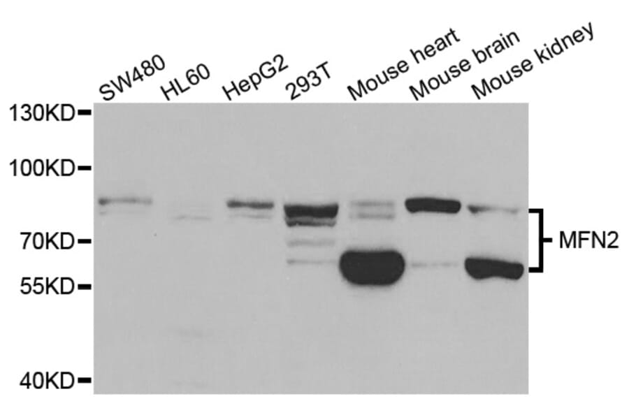 Anti-MFN2 Antibody (A38567) | Antibodies.com