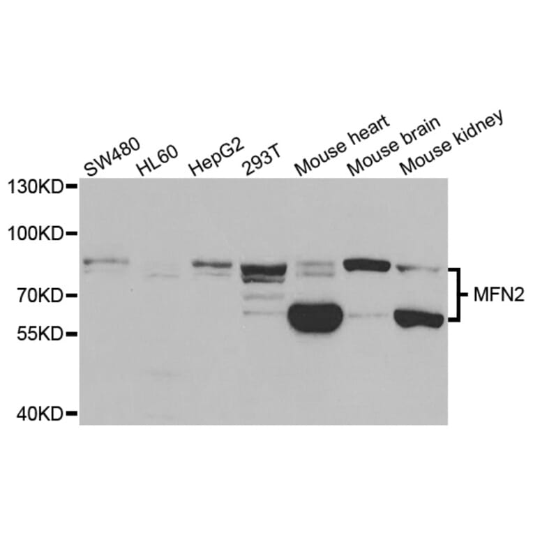 Western blot - MFN2 Antibody from Signalway Antibody (33015) - Antibodies.com