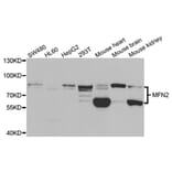 Western blot - MFN2 Antibody from Signalway Antibody (33015) - Antibodies.com