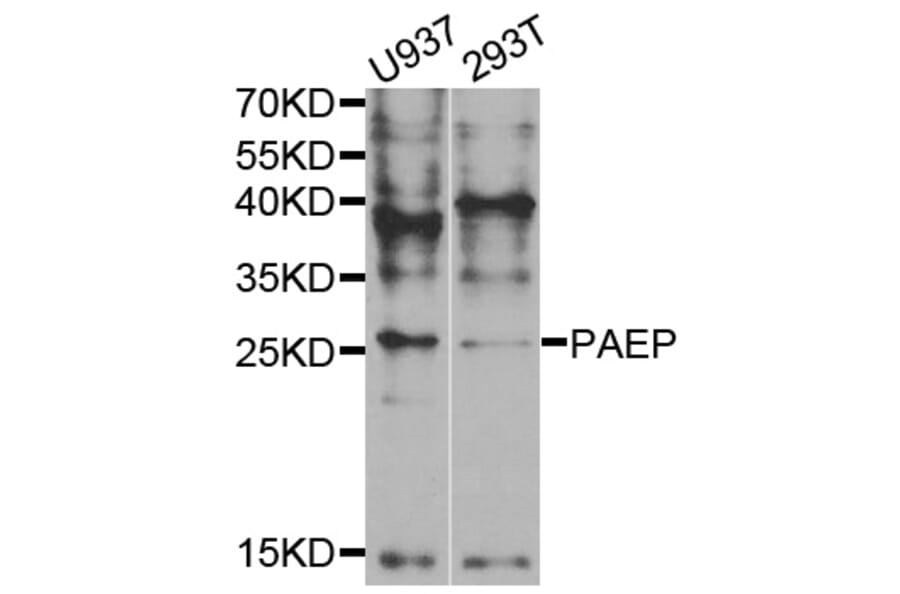 Western blot - PAEP Antibody from Signalway Antibody (33016) - Antibodies.com