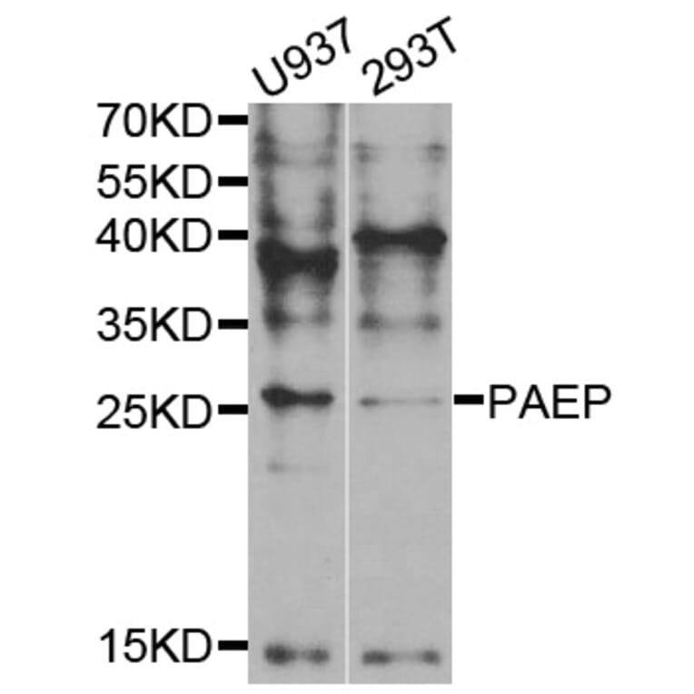 Western blot - PAEP Antibody from Signalway Antibody (33016) - Antibodies.com