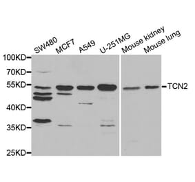 Western blot - TCN2 Antibody from Signalway Antibody (33019) - Antibodies.com