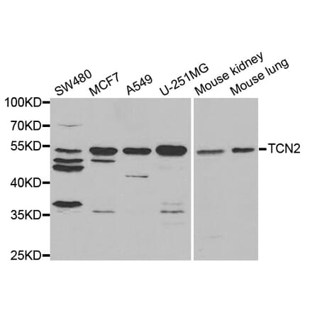 Western blot - TCN2 Antibody from Signalway Antibody (33019) - Antibodies.com