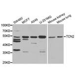 Western blot - TCN2 Antibody from Signalway Antibody (33019) - Antibodies.com
