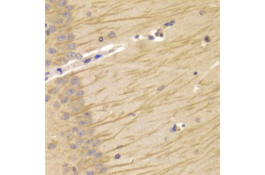 Immunohistochemistry - TCN2 Antibody from Signalway Antibody (33019) - Antibodies.com