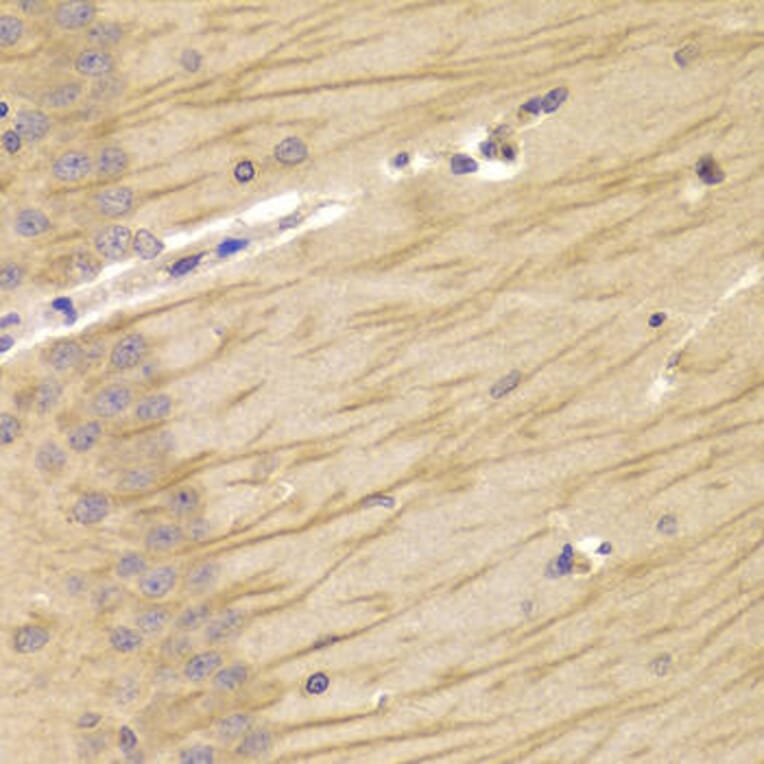 Immunohistochemistry - TCN2 Antibody from Signalway Antibody (33019) - Antibodies.com