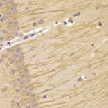 Immunohistochemistry - TCN2 Antibody from Signalway Antibody (33019) - Antibodies.com