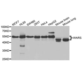 Western blot - WARS Antibody from Signalway Antibody (33022) - Antibodies.com