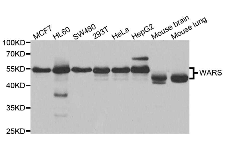 Western blot - WARS Antibody from Signalway Antibody (33022) - Antibodies.com