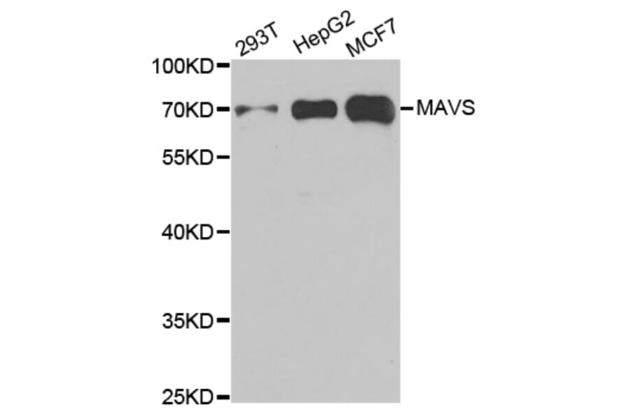 Western blot - MAVS Antibody from Signalway Antibody (33026) - Antibodies.com
